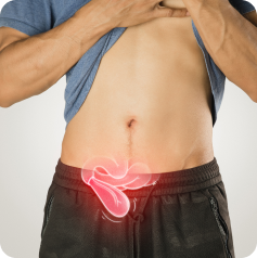 Hernia Surgery